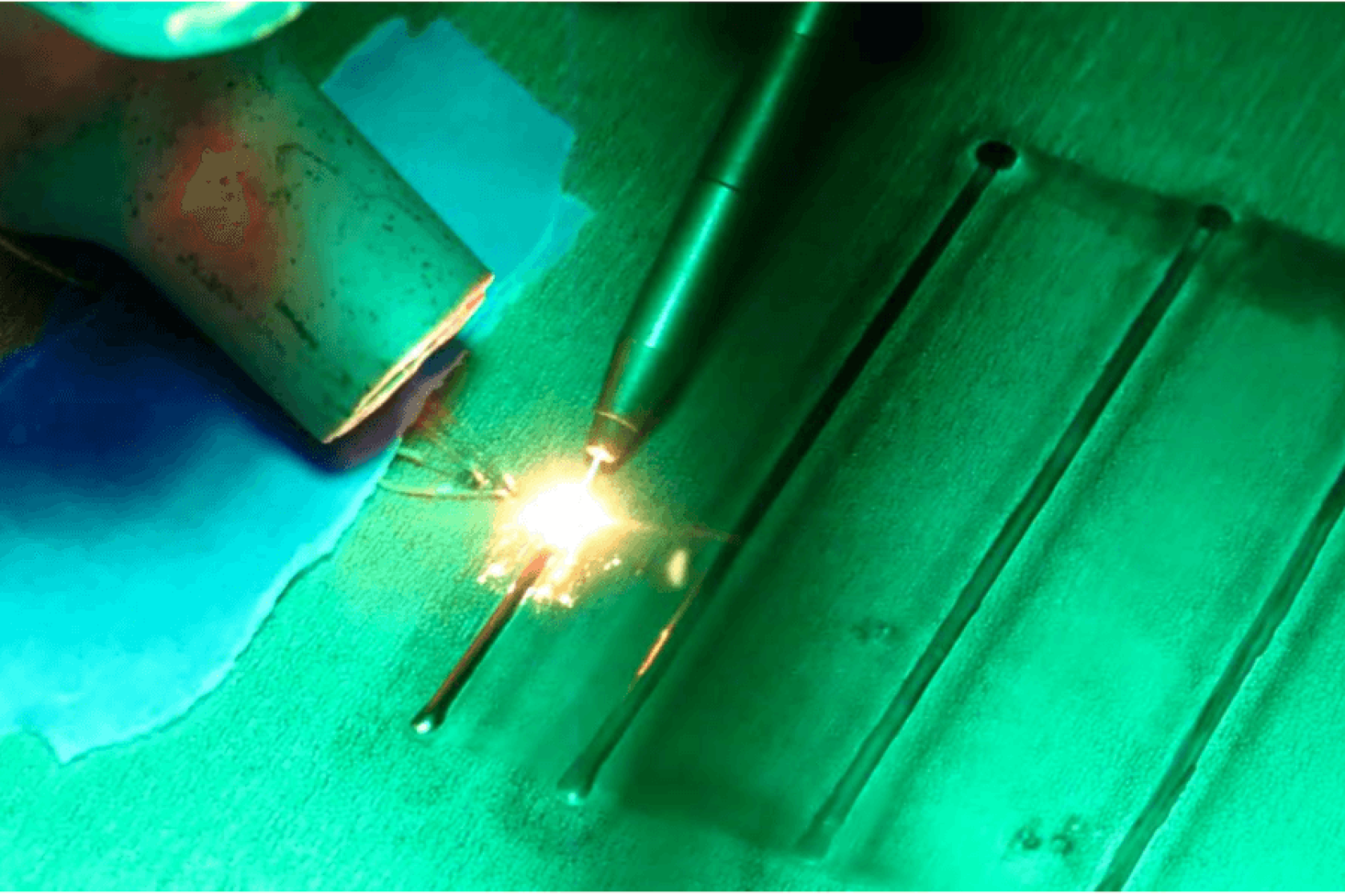 ABSI laser weld